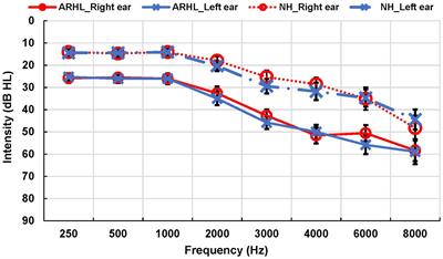 Alpha and theta oscillations on a visual strategic processing task in age-related hearing loss